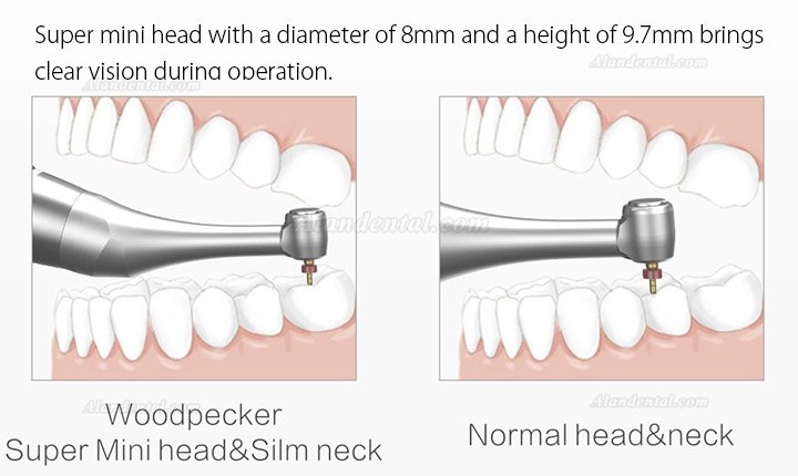 Woodpecker Ai-Motor Dental Endo Motor Apex Locator Brushless Cordless